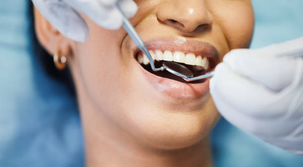 Best Emergency Broken Tooth Repair in Memphis, FL