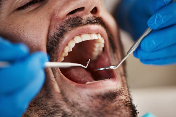Best Emergency Orthodontic Repairs in Memphis, FL